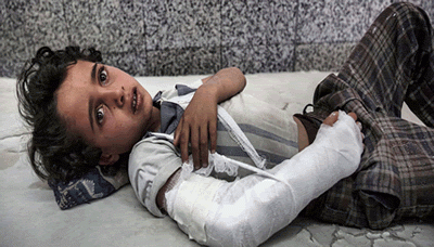  مؤتمر صحفي بصنعاء حول معاناة أطفال اليمن والمطالبة بسرعة إنقاذهم من الموت 28 08 218 